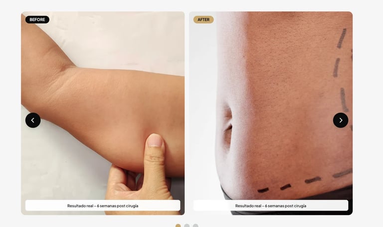 Before and after comparison of surgical arm procedure results showing skin incisions and healing